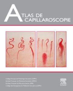 Atlas De Capillaroscopie 9782294726613