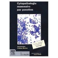 Cytopathologie mammaire par ponction