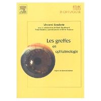 Les greffes en ophtalmologie