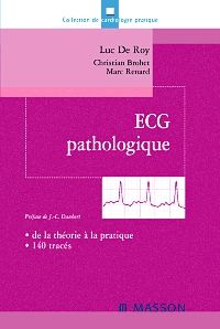 ECG pathologique