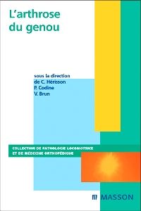 L'arthrose du genou