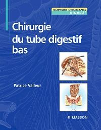 Chirurgie du tube digestif bas