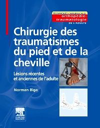 Chirurgie des traumatismes du pied et de la cheville