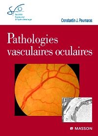 Pathologies vasculaires oculaires