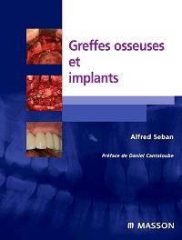 Greffes osseuses et implants