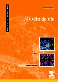 Maladies du sein