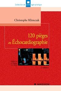 120 pièges en Échocardiographie