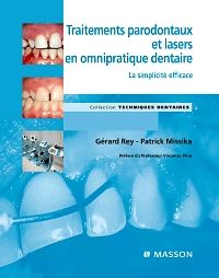 Traitements parodontaux et lasers en omnipratique dentaire