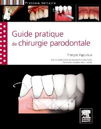 Guide pratique de chirurgie parodontale