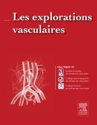 Les explorations vasculaires