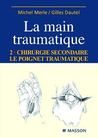 La Main traumatique. Tome 2. Chirurgie secondaire, le poignet traumatique