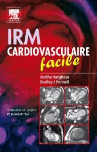 IRM cardiovasculaire facile