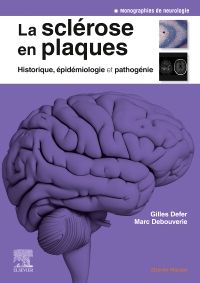 La sclérose en plaques - Historique, épidémiologie et pathogénie