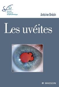 Les uvéites