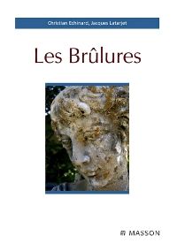 Les brûlures