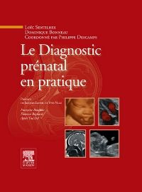 Le Diagnostic prénatal en pratique