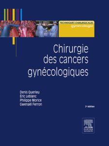 Chirurgie des cancers gynécologiques