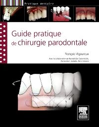 Guide pratique de chirurgie parodontale