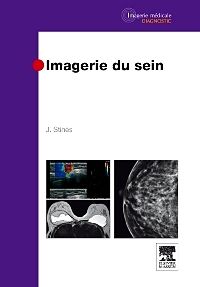 Imagerie du sein