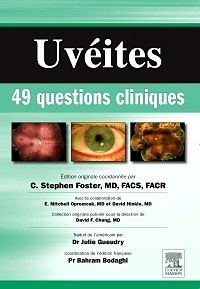 Uvéites : 49 questions cliniques