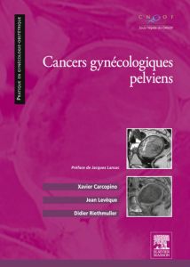 Cancers gynécologiques pelviens