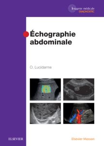 Echographie abdominale