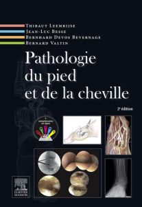 Pathologie du pied et de la cheville