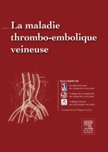 La maladie thrombo-embolique veineuse