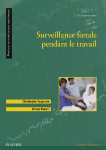 Surveillance fœtale pendant le travail