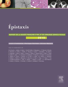 Les épistaxis