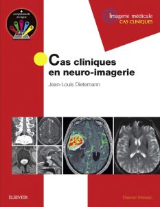 Cas cliniques en neuro-imagerie