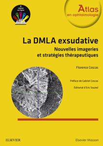 La DMLA exsudative