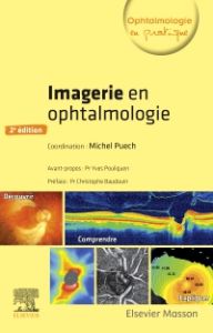 Imagerie en ophtalmologie