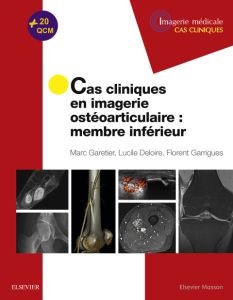 Cas cliniques en imagerie ostéoarticulaire : membre inférieur