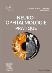 Neuro-ophtalmologie pratique