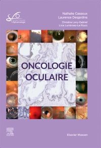 Oncologie oculaire