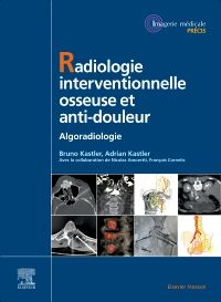 Radiologie Interventionnelle osseuse et anti-douleur