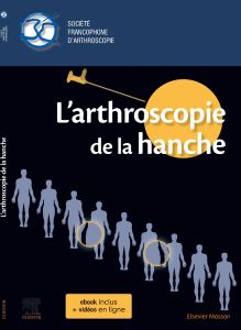 L'arthroscopie de la hanche