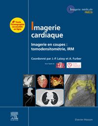 Imagerie cardiaque