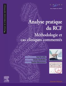 Analyse pratique  du RCF : rythme cardiaque foetal