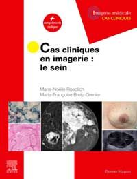 Cas cliniques en imagerie : le sein