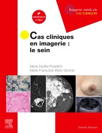 Cas cliniques en imagerie : le sein