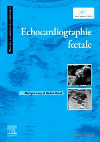 Echocardiographie fœtale