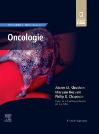 Imagerie médicale : Oncologie