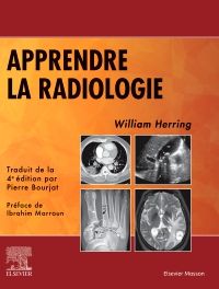 Apprendre la radiologie