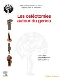 Les ostéotomies autour du genou