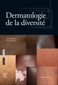 Dermatologie de la diversité