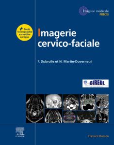 Imagerie cervicofaciale