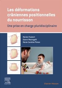 Les déformations crâniennes positionnelles du nourrisson