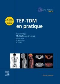 TEP-TDM en pratique